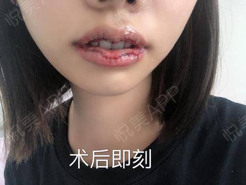 厚唇小嘴面相：吉祥与运势的深层解读