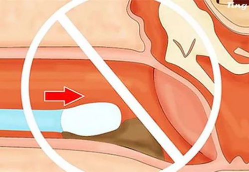 梦见掏耳朵屎是什么征兆？有什么特殊含义？