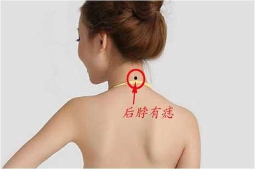 前颈痣象：人际关系与情感困境