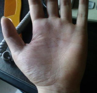 断掌现象及其衍生意义