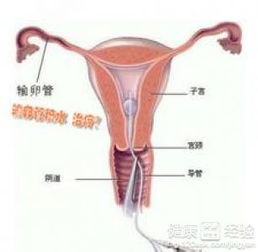 别急着动刀！这一些神奇的非手术医治真实的存在？