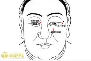 什么样的八字或克妻痣图片能判断一个人克妻？