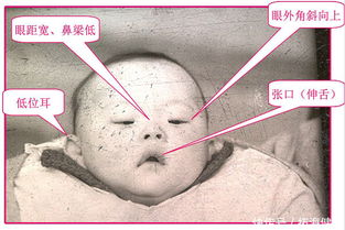 面相学视角：眼距宽的国学解读与性格隐喻