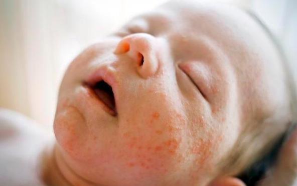 1.1 牛乳及乳制品中的酪蛋白与乳清蛋白