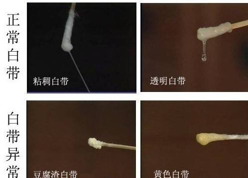 2-2 病理性原因