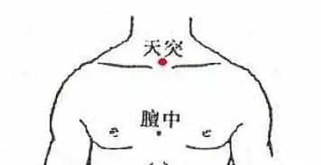 3．天突穴：胸腔较深层抗痰镇静标靶