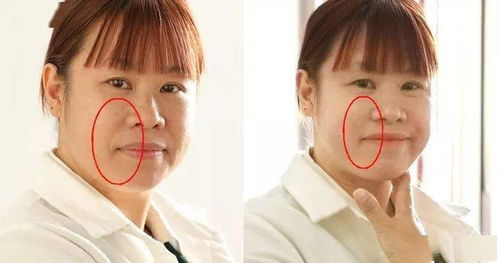 二、 不同形态法令纹所代表的命运走向