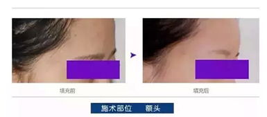 前言：整容是否嫩够根本性地改变个体的命运与运势