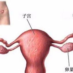 二、 上皮细胞为何会在白带中出现