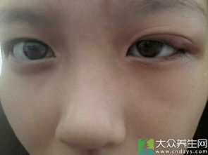 1. 男性白天右眼皮跳动之解读