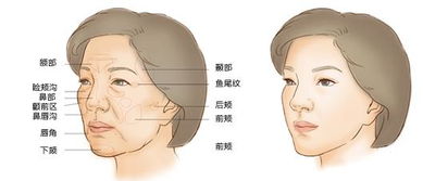 2. 以面部形态判别时辰