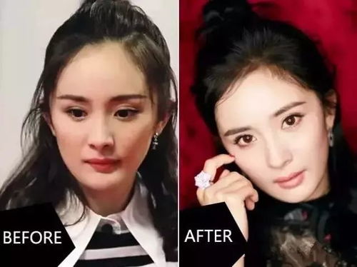 2. 两侧凸起——桃花劫与财运寿运之潜在风险