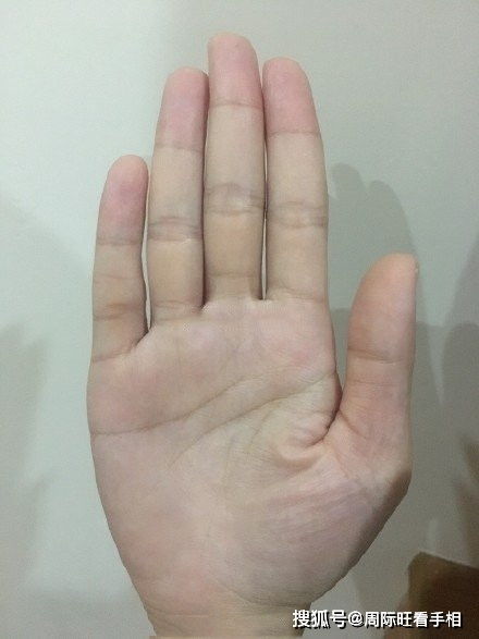 (3) 健康及家族关联