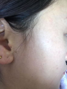 耳根与耳背：健康预警与亲缘关系的隐喻