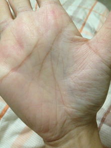 掌纹结构与认知风格