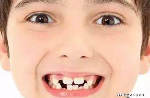 下牙八字牙的人，右边的下牙究竟叫什么牙？