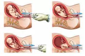 三、  属鼠、属龙与属猴女性的营养补充与作息规律