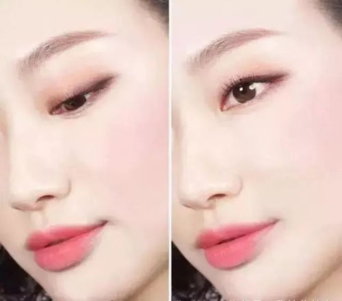 笑时眉毛成八字，两侧鼓包是何原因？