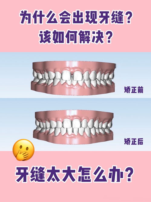先天性因素：遗传基因对牙齿形态的影响