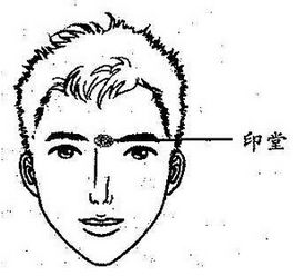 印堂发黑的病理机制与成因分析
