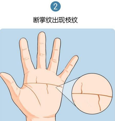 手相理论 ： 断 Palm 与 川 Palm 对人生运势的影响