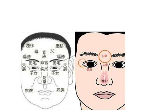 3.2 卧蚕与笑纹的复合效应
