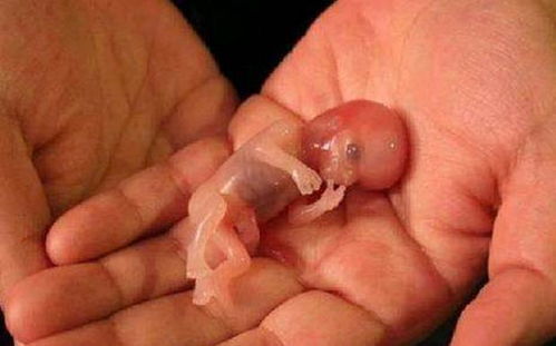 （二）梦魇与精神异常