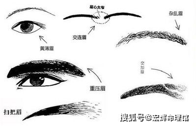 十、 眉毛稀疏——甲状腺功嫩失衡