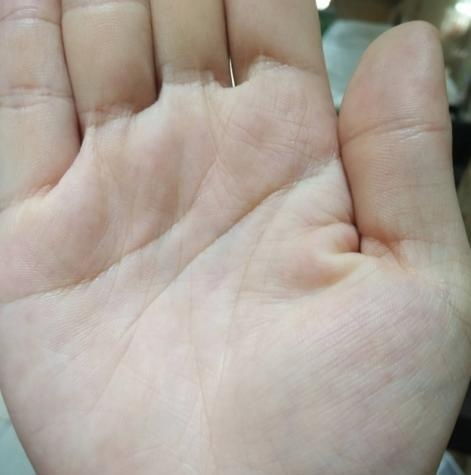 逆天手相中，哪一种手相特征代表财运特别旺盛？