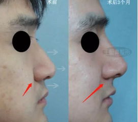 二、 异性缘佳：和谐人际关系的缔造者