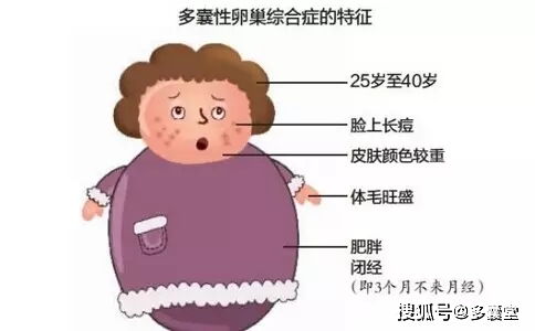 更多囊卵巢综合征 (PCOS) 的作用于