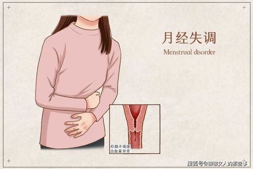 3.2 运动过度或缺乏运动——极端极端极端！
