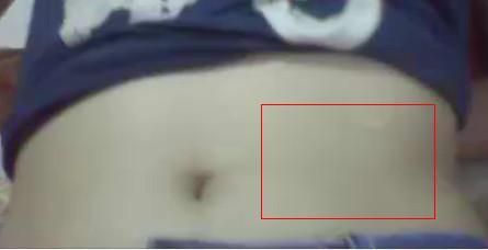 肚脐眼长痦子吉凶？肚脐左边长痦子是好运还是坏运？