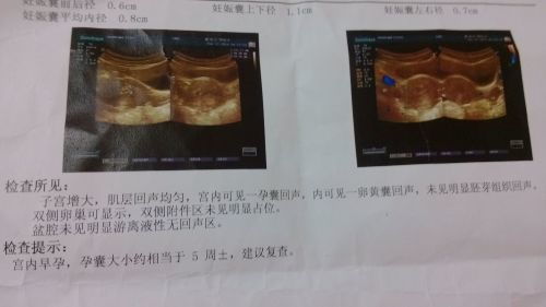 六、从心理状态角度看：为哪些我们如此关注这件事？