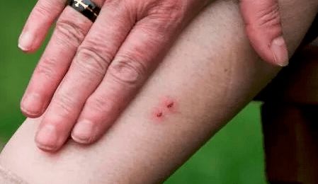 梦见左手被咬伤或被蛇咬了这预示着什么不祥的征兆或即将发生什么不幸的事情呢？