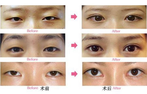 四、 医美干预：技术手段选择及术后管理原则
