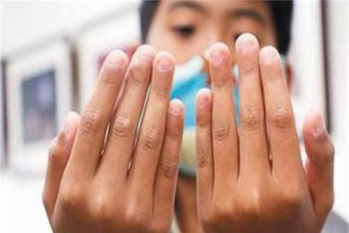 梦见手被咬疼是什么预兆？预示着什么不好的事情即将发生？