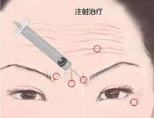 如何去除5年左右的红眉，恢复男性面相的清爽？