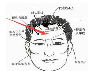 额头有痣：远见卓识与机遇把握能力的体现