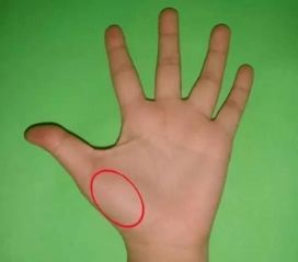 手部青筋与病症的相关性