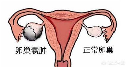 四、不必恐慌——生活方式调整也能帮上忙！