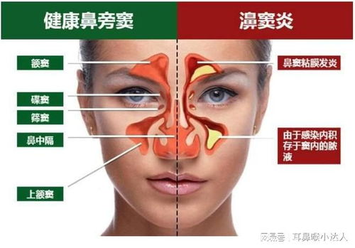 常见病因分析