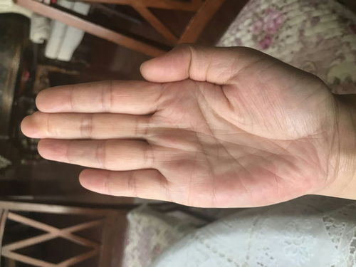 三、蝴蝶筋：才华横溢的命运象征