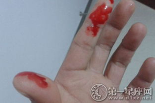 梦到自己流鼻血止不住预示着什么不祥的征兆？