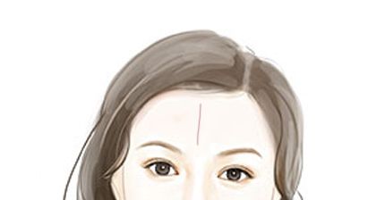 额头两侧长包风水运势如何？