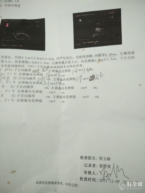 日常自检较小技巧：白带告诉你啥