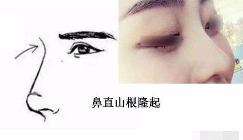 “盛囊”与“袋”两种典型形态比较说明