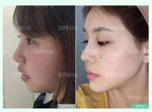 变身后的青蛙王子：凶险与恐慌的化身