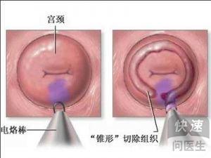 1. 炎症反应