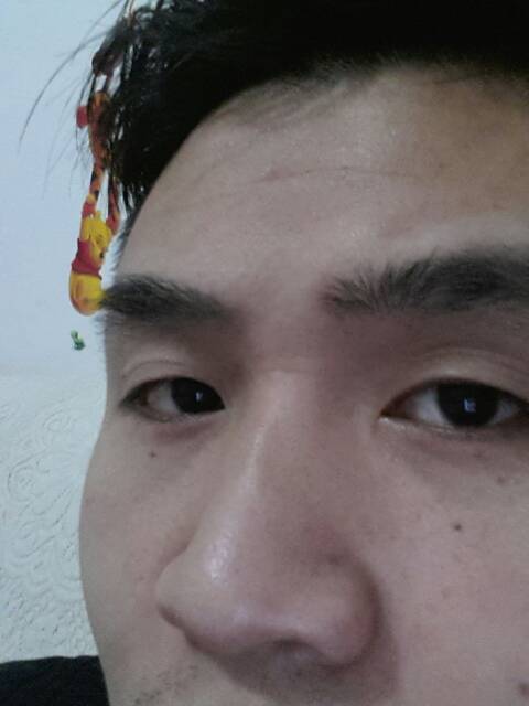 眼周区域：健康状况的隐喻